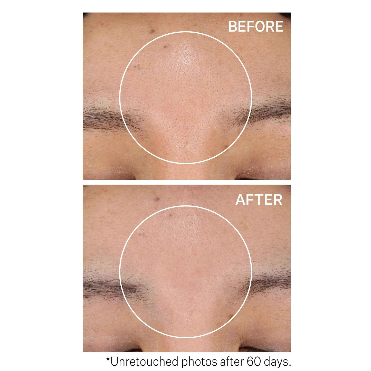 Strivectin Advanced Resurfacing Daily Reveal Exfoliating 60 Pads