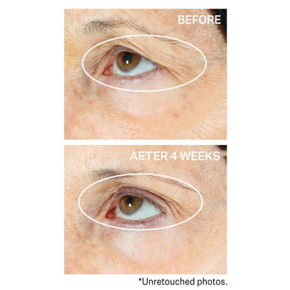 Strivectin Tighten & Lift Peptight 360º Tightening Eye Serum