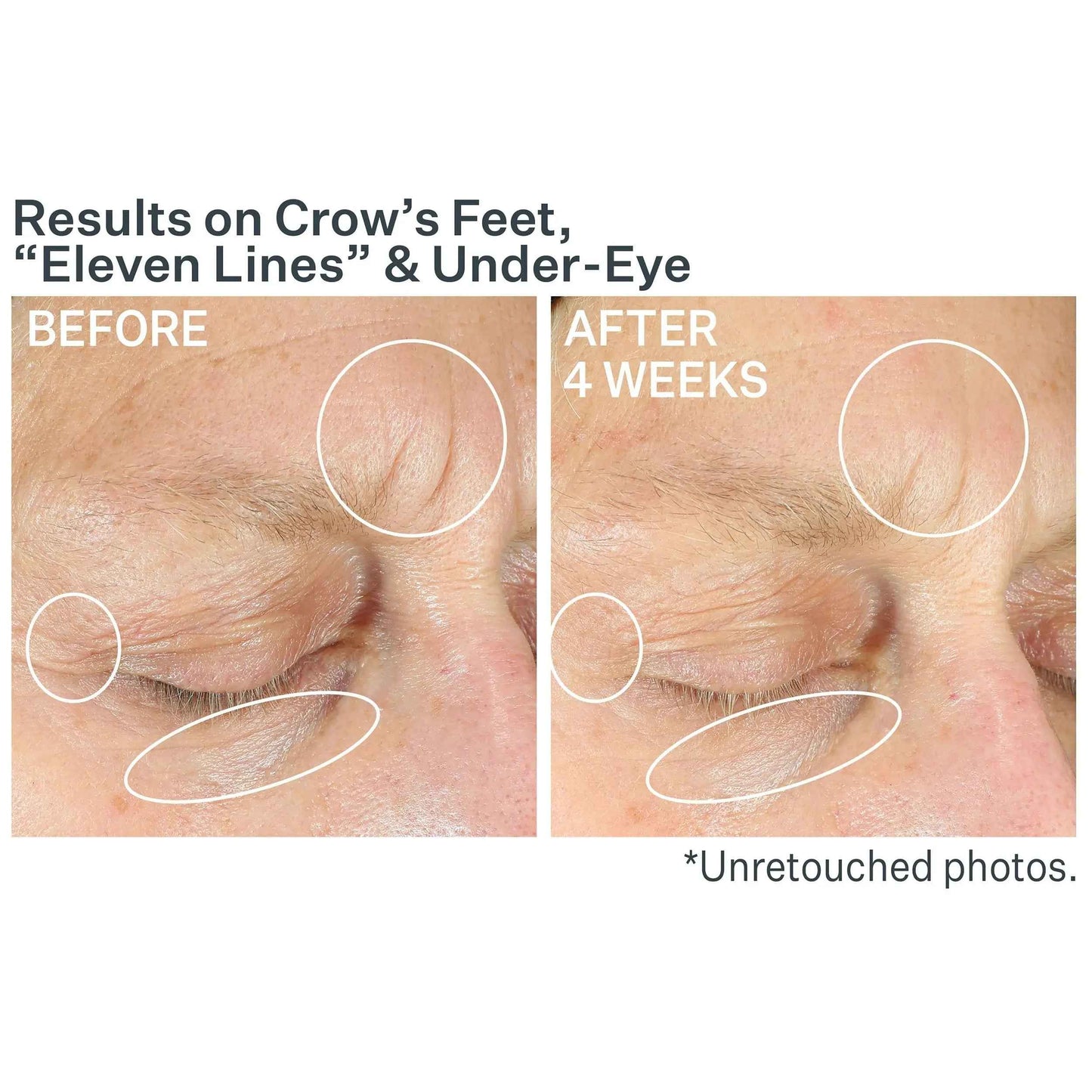 Strivectin Anti-Wrinkle Intensive Eye Concentrate for Wrinkles PLUS