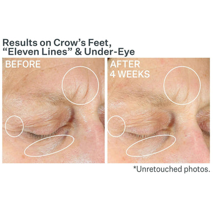 Strivectin Anti-Wrinkle Intensive Eye Concentrate for Wrinkles PLUS