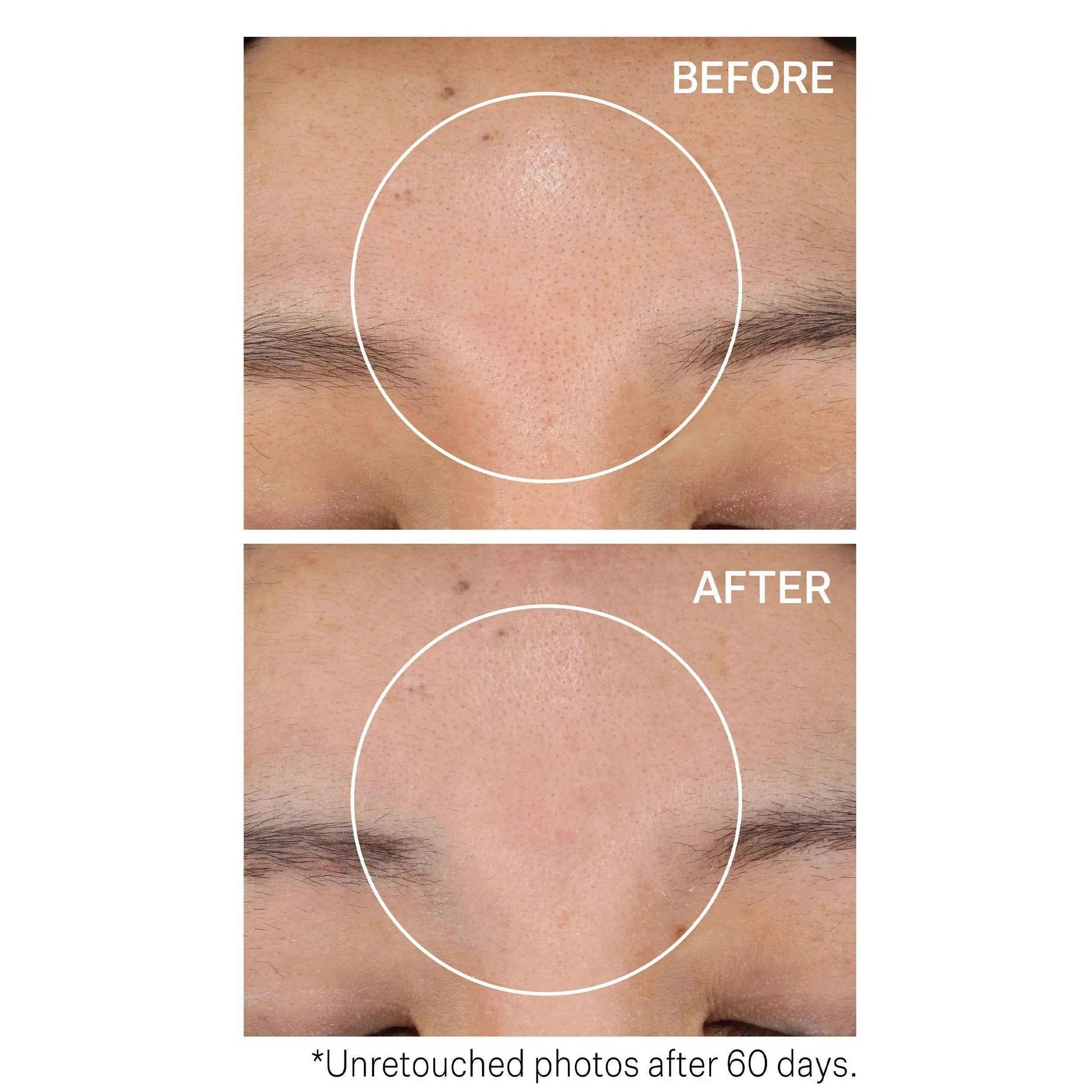 Strivectin Advanced Resurfacing Daily Reveal Exfoliating 60 Pads