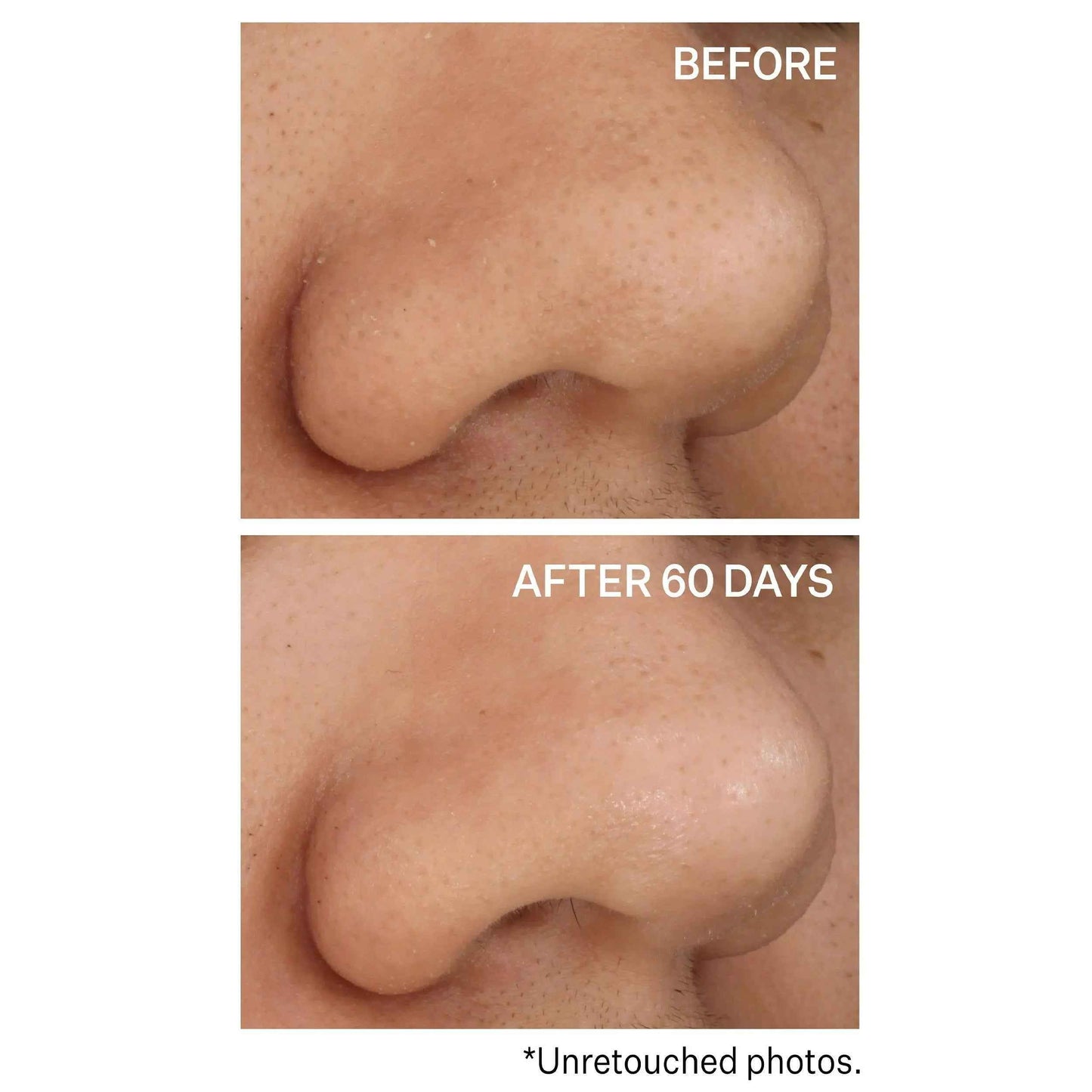 Strivectin Advanced Resurfacing Daily Reveal Exfoliating 60 Pads