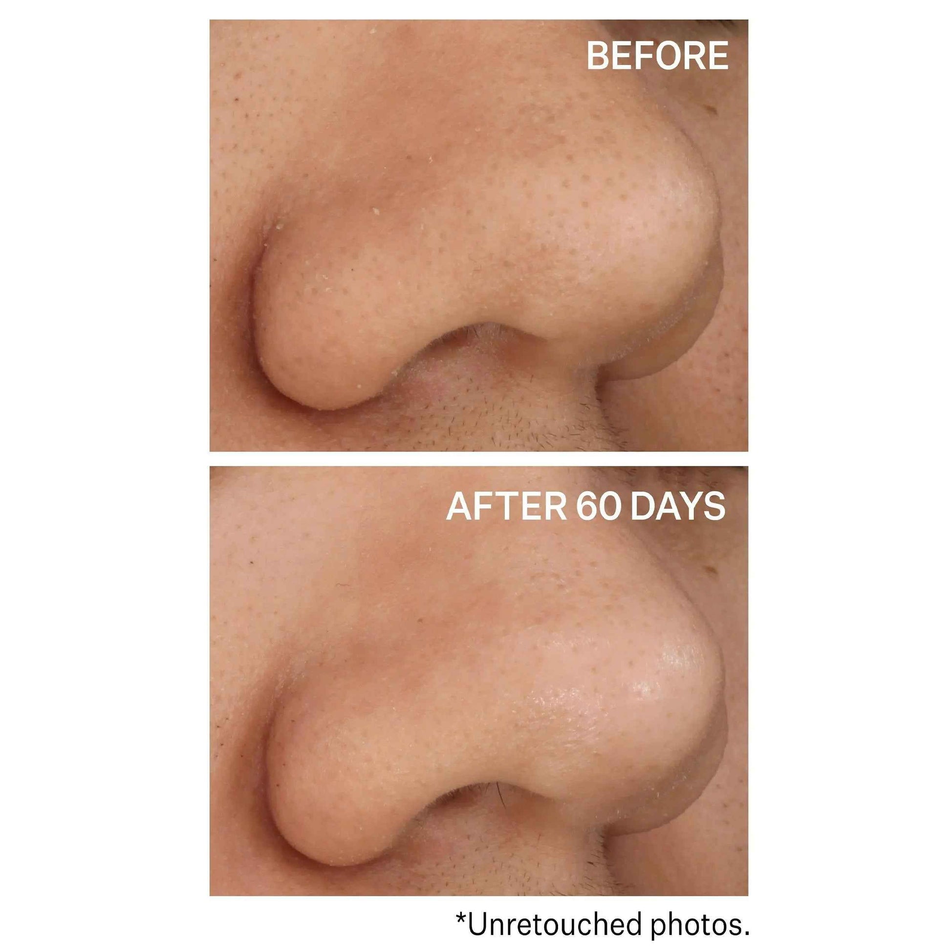 Strivectin Advanced Resurfacing Daily Reveal Exfoliating 60 Pads