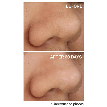 Strivectin Advanced Resurfacing Daily Reveal Exfoliating 60 Pads