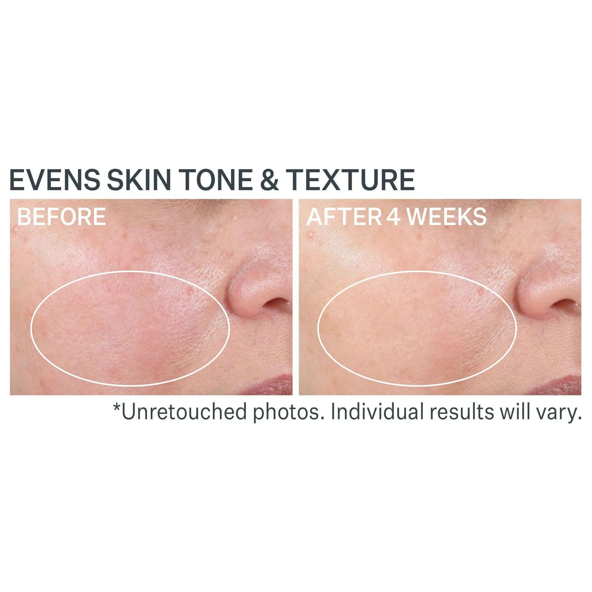 Strivectin Advanced Retinol Nightly Renewal Moisturizer