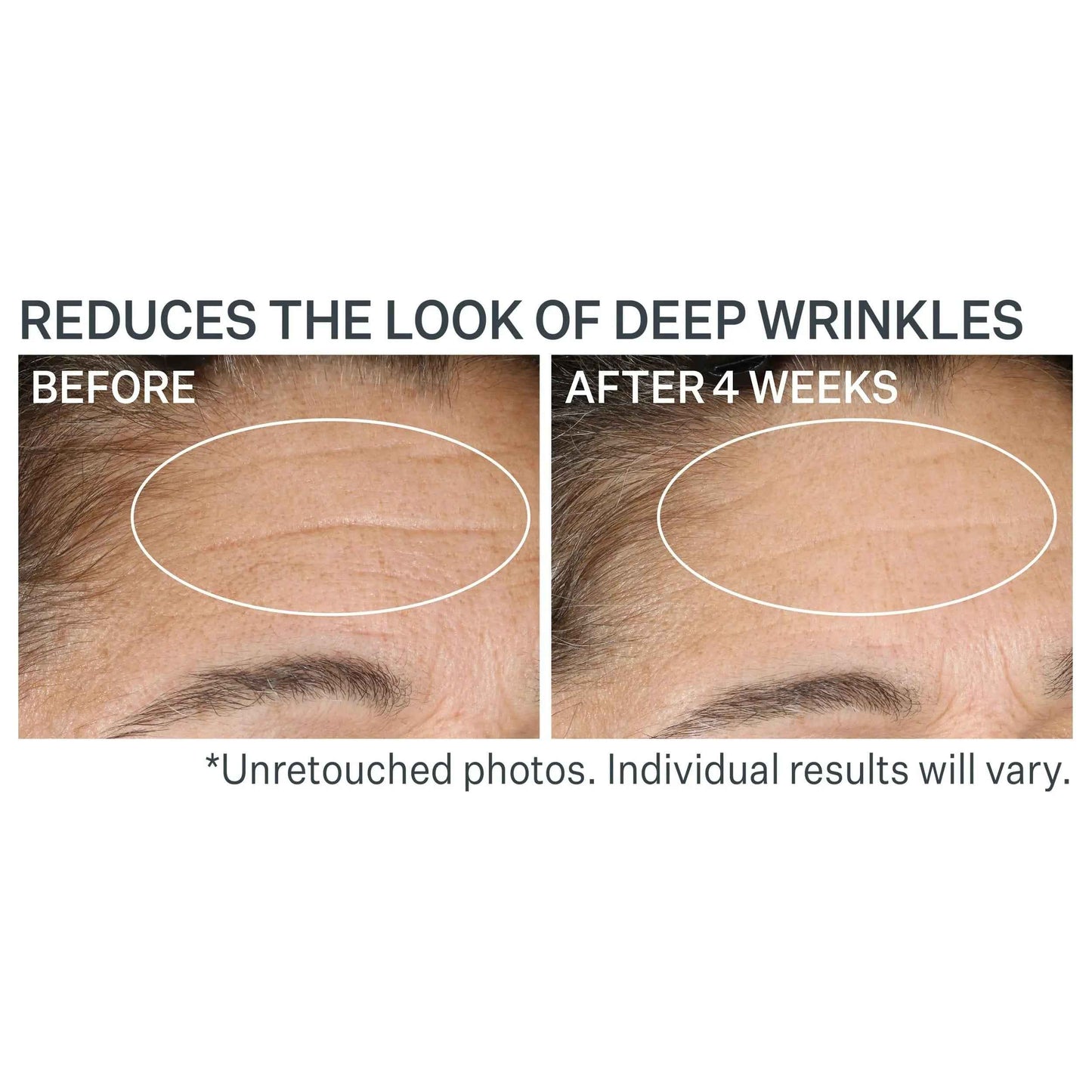 Strivectin Advanced Retinol Nightly Renewal Moisturizer