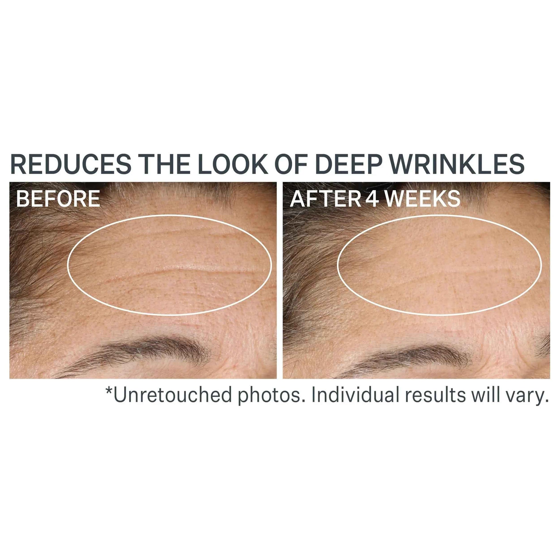 Strivectin Advanced Retinol Nightly Renewal Moisturizer