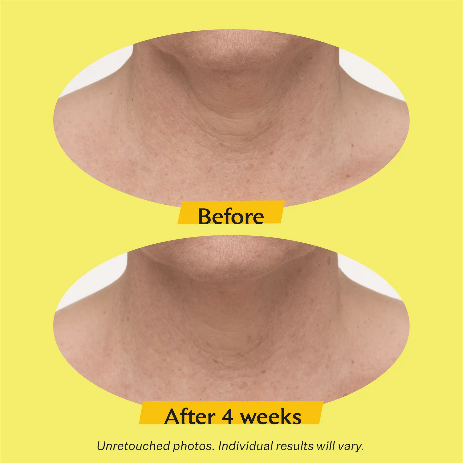 Strivectin  TL Advanced Tightening Neck Cream PLUS - Amazing Beauty LLC