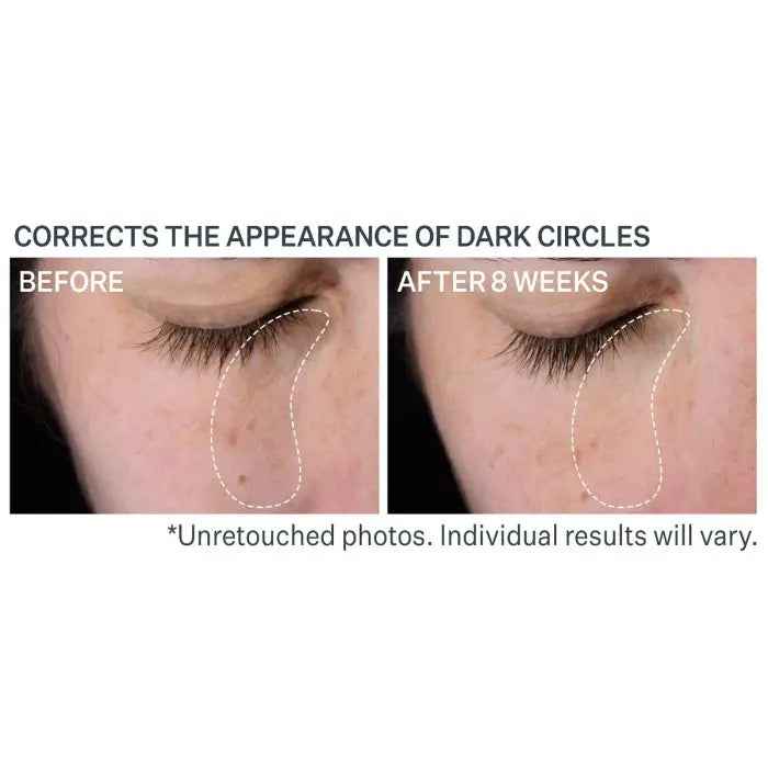 Strivectin Multi-Action Super-C Dark Circle Brightening Eye Serum