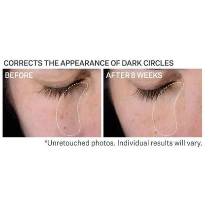 Strivectin Multi-Action Super-C Dark Circle Brightening Eye Serum