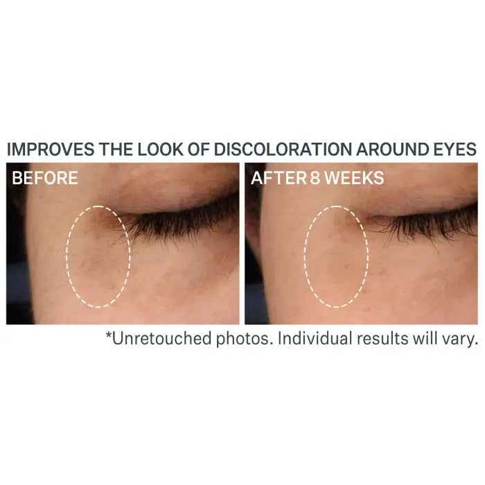 Strivectin Multi-Action Super-C Dark Circle Brightening Eye Serum